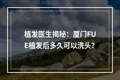 植发医生揭秘：厦门FUE植发后多久可以洗头？