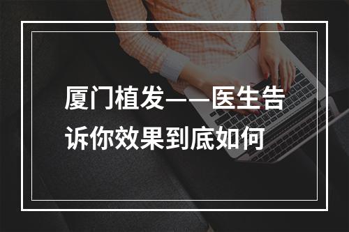 厦门植发——医生告诉你效果到底如何