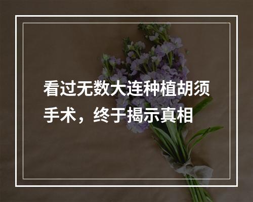 看过无数大连种植胡须手术，终于揭示真相