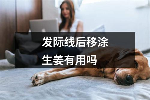 发际线后移涂生姜有用吗