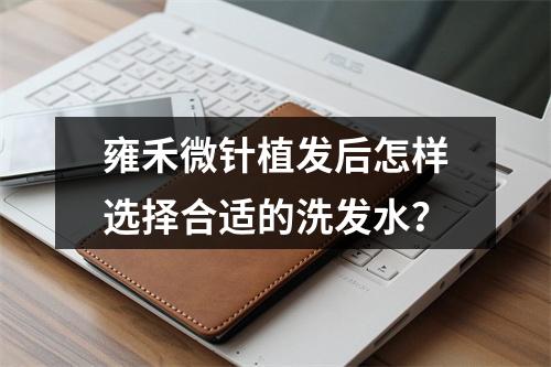 雍禾微针植发后怎样选择合适的洗发水？