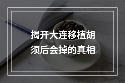 揭开大连移植胡须后会掉的真相