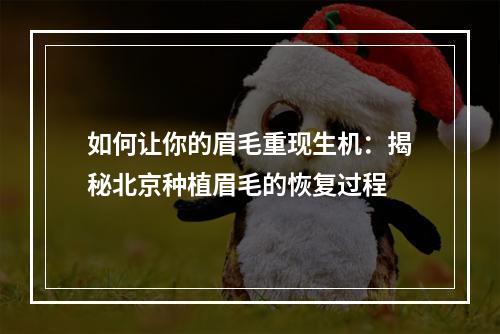 如何让你的眉毛重现生机：揭秘北京种植眉毛的恢复过程