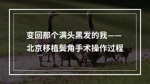 变回那个满头黑发的我——北京移植鬓角手术操作过程