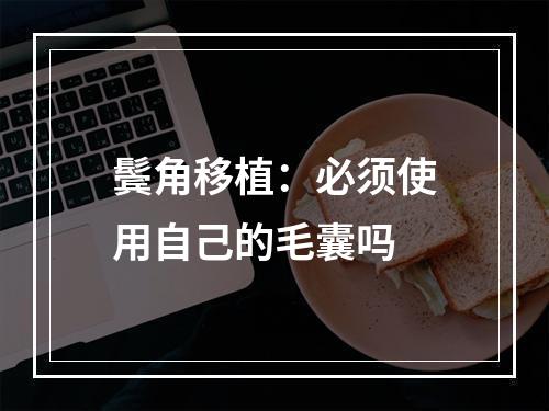 鬓角移植：必须使用自己的毛囊吗