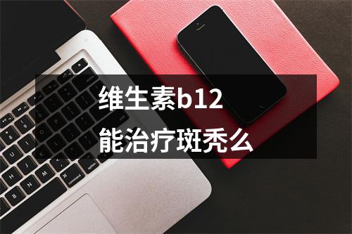 维生素b12能治疗斑秃么