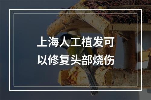 上海人工植发可以修复头部烧伤