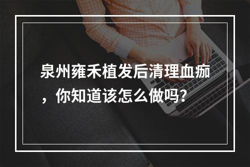 泉州雍禾植发后清理血痂，你知道该怎么做吗？