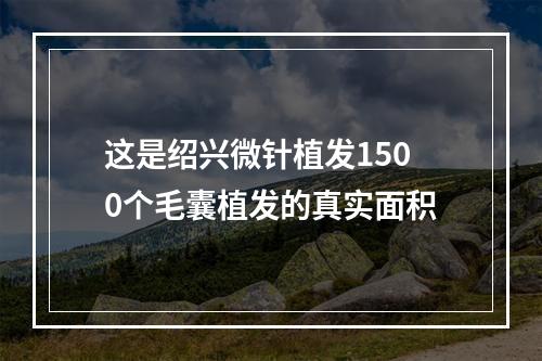 这是绍兴微针植发1500个毛囊植发的真实面积