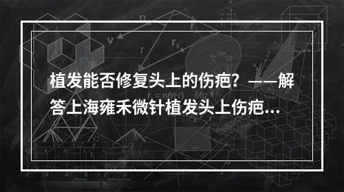 植发能否修复头上的伤疤？——解答上海雍禾微针植发头上伤疤能植发吗