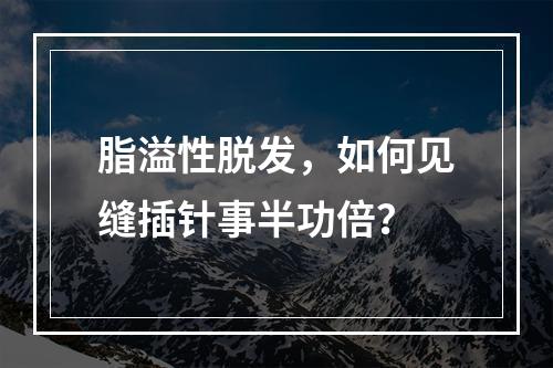 脂溢性脱发，如何见缝插针事半功倍？