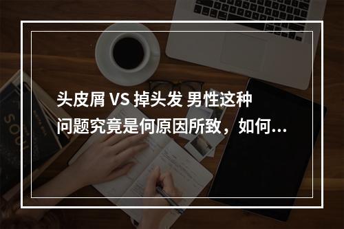 头皮屑 VS 掉头发 男性这种问题究竟是何原因所致，如何治疗？