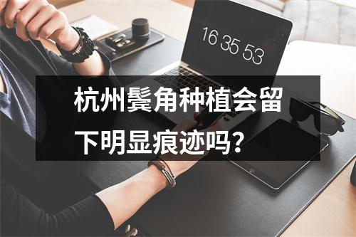 杭州鬓角种植会留下明显痕迹吗？