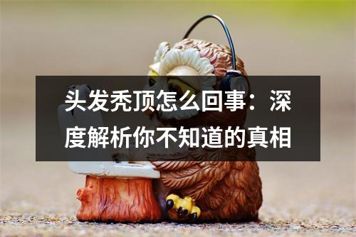 头发秃顶怎么回事：深度解析你不知道的真相