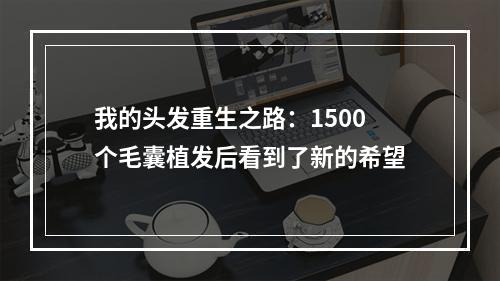 我的头发重生之路：1500个毛囊植发后看到了新的希望