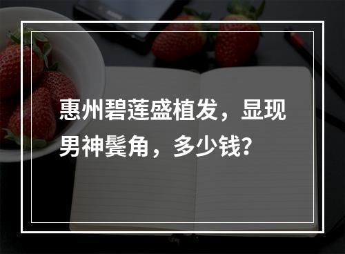 惠州碧莲盛植发，显现男神鬓角，多少钱？