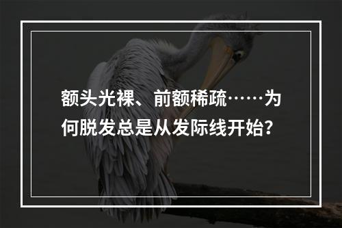 额头光裸、前额稀疏……为何脱发总是从发际线开始？