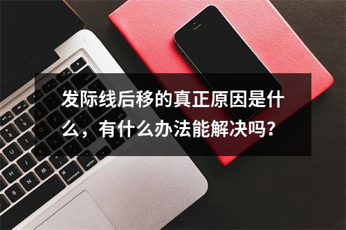 发际线后移的真正原因是什么，有什么办法能解决吗？