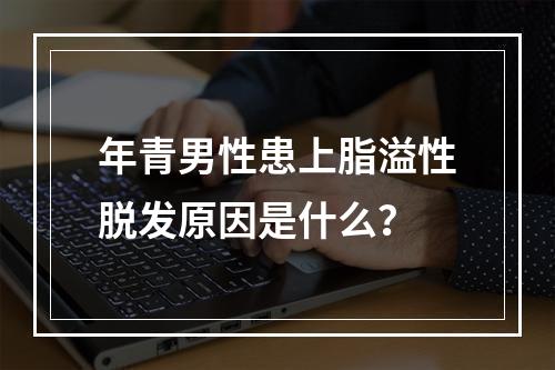 年青男性患上脂溢性脱发原因是什么？