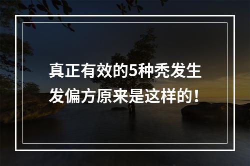 真正有效的5种秃发生发偏方原来是这样的！