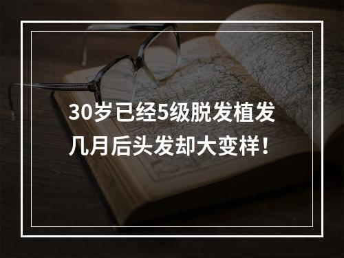 30岁已经5级脱发植发几月后头发却大变样！