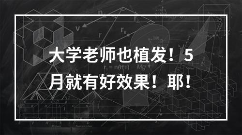 大学老师也植发！5月就有好效果！耶！