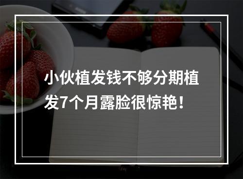 小伙植发钱不够分期植发7个月露脸很惊艳！