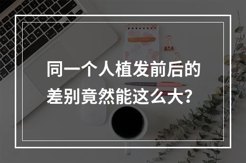 同一个人植发前后的差别竟然能这么大？