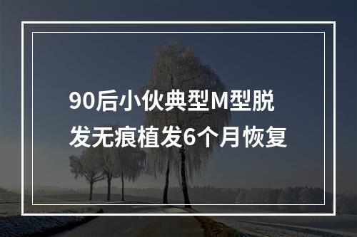 90后小伙典型M型脱发无痕植发6个月恢复