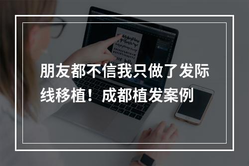 朋友都不信我只做了发际线移植！成都植发案例