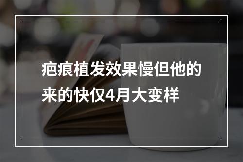 疤痕植发效果慢但他的来的快仅4月大变样