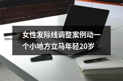 女性发际线调整案例动一个小地方立马年轻20岁