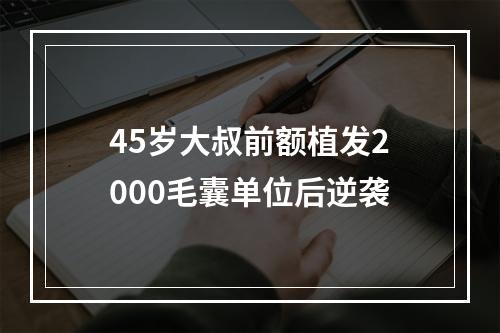 45岁大叔前额植发2000毛囊单位后逆袭