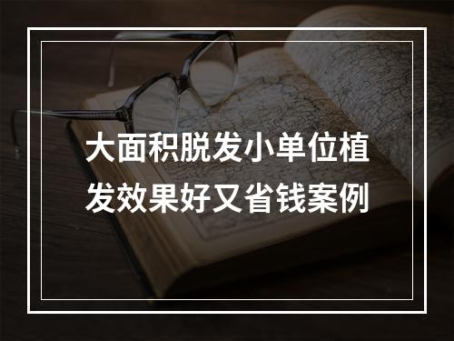 大面积脱发小单位植发效果好又省钱案例