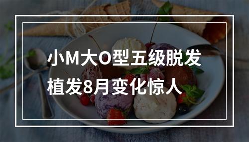 小M大O型五级脱发植发8月变化惊人