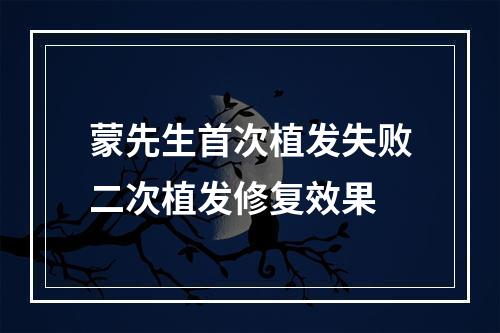 蒙先生首次植发失败二次植发修复效果