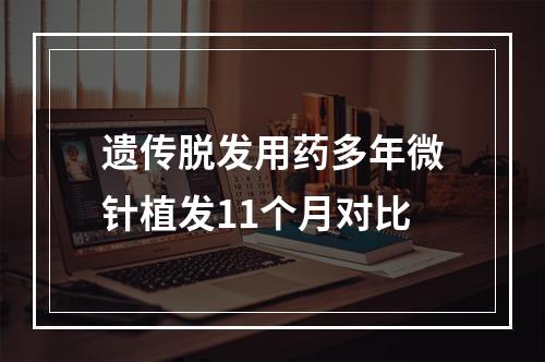 遗传脱发用药多年微针植发11个月对比