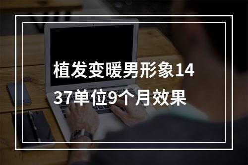 植发变暖男形象1437单位9个月效果