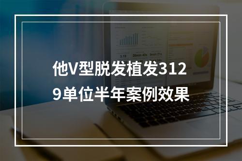 他V型脱发植发3129单位半年案例效果