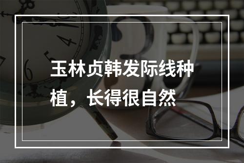 玉林贞韩发际线种植，长得很自然