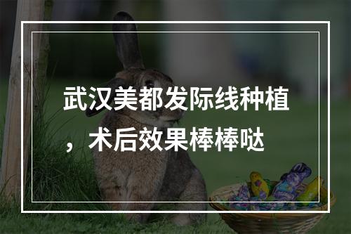 武汉美都发际线种植，术后效果棒棒哒