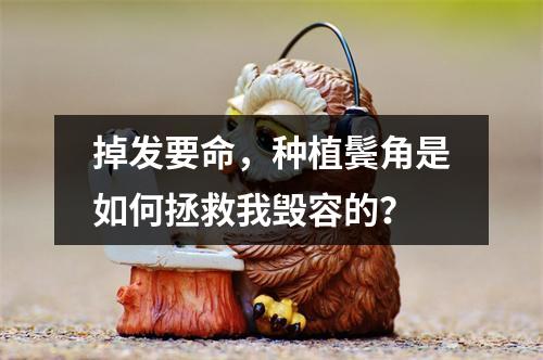 掉发要命，种植鬓角是如何拯救我毁容的？