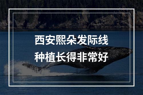 西安熙朵发际线种植长得非常好