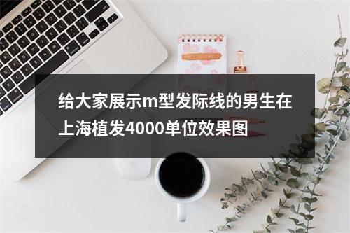 给大家展示m型发际线的男生在上海植发4000单位效果图