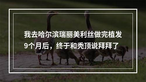 我去哈尔滨瑞丽美利丝做完植发9个月后，终于和秃顶说拜拜了