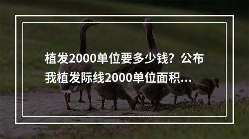 植发2000单位要多少钱？公布我植发际线2000单位面积图和价格