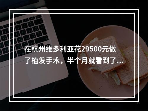 在杭州维多利亚花29500元做了植发手术，半个月就看到了效果