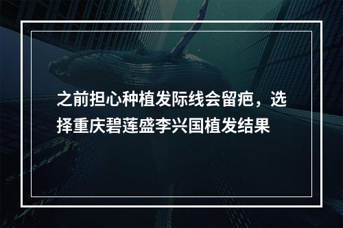 之前担心种植发际线会留疤，选择重庆碧莲盛李兴国植发结果