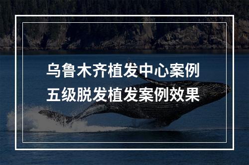 乌鲁木齐植发中心案例 五级脱发植发案例效果