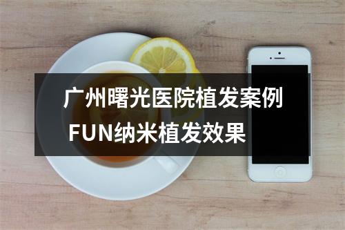 广州曙光医院植发案例 FUN纳米植发效果